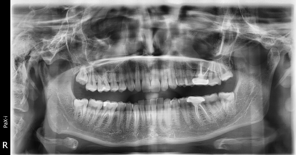 inbound1880587866248441566