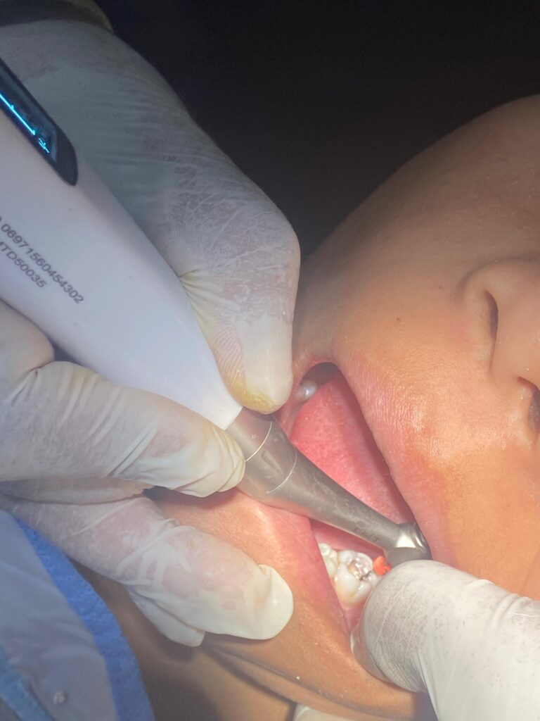 inbound4417090177130857035